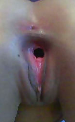 14 of 15