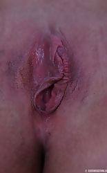 19 of 20